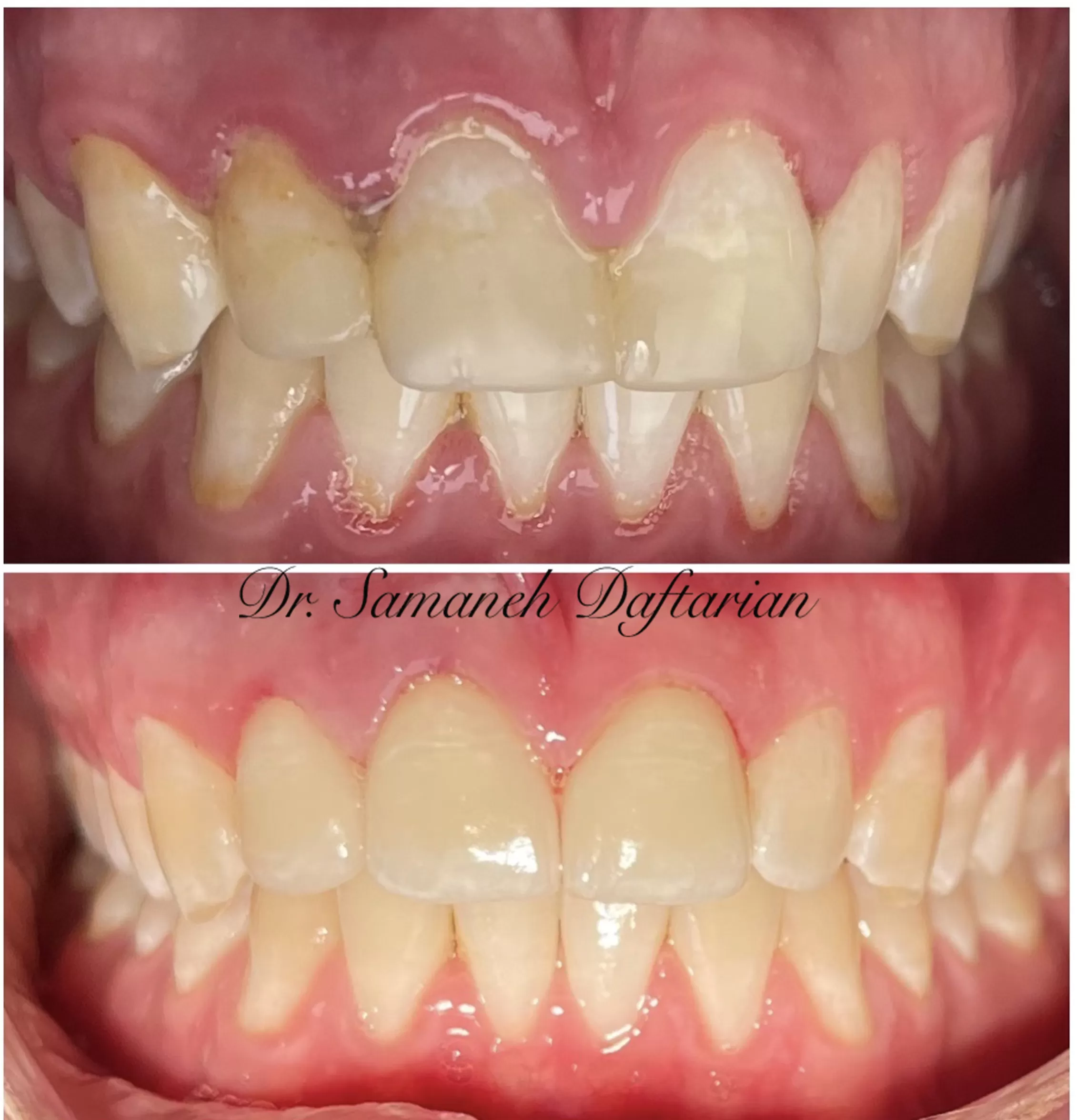 Before and After Teeth client picture